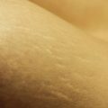 Fotografie, die den Ausschnitt eines Körpers in Nahaufnahme zeigt. Auf der Haut sind Dehnungsstreifen.