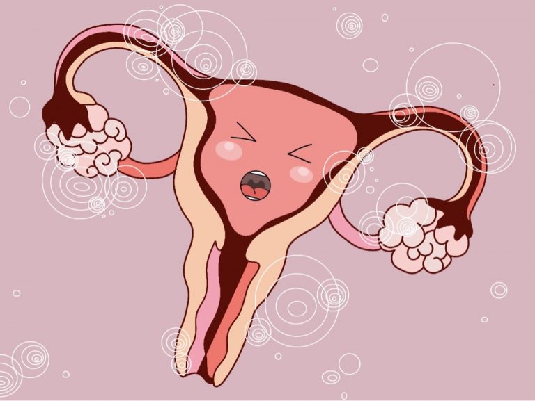 Comichafte Zeichnung einer Gebärmutter die schreit in rot und rosafarben